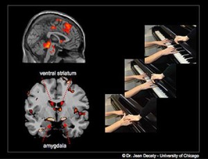 fMRI images 